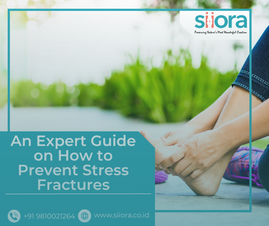 An Expert Guide on How to Prevent Stress Fractures Wikiful